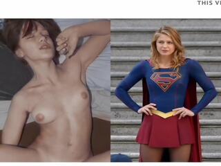 Melissa benoist supergirl, Libre provocative nudists hd pornograpya maging